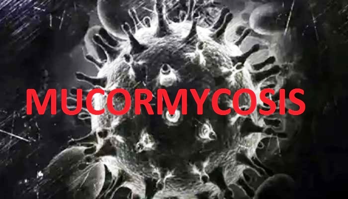 task force of doctors formed for Mucormycosis